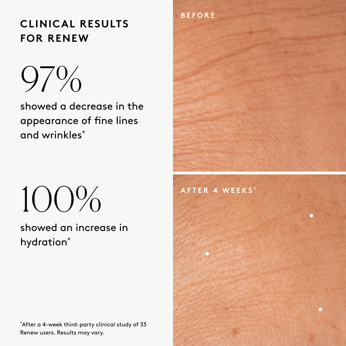 Smooth Skin Edit Gift Set: For silky-soft skin