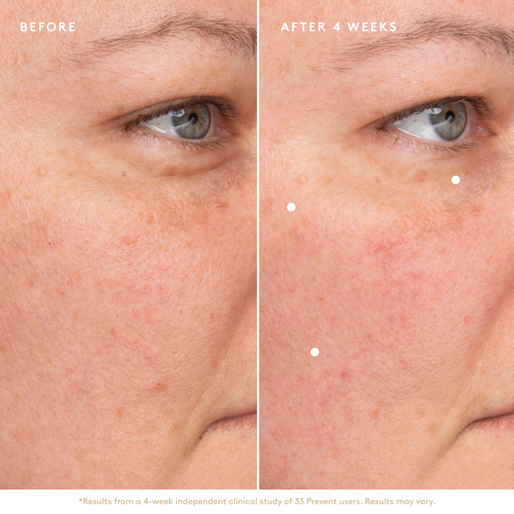 
                  
                    Before and after Prevent Anti-Aging Face Oil
                  
                