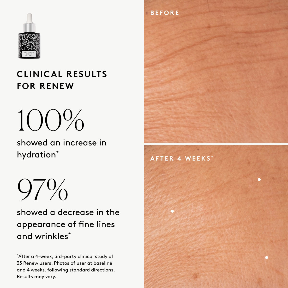 
                
                  Clinical results chart for Renew Resurfacing Night Serum: 100% showed increased visible hydration and 97% showed improved visible wrinkles
                
              