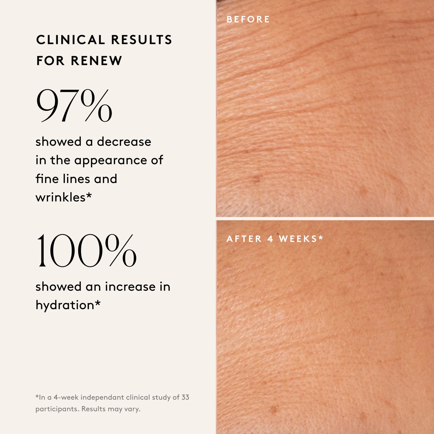 
                
                  Bright Complexion Set: For a Brighter Look
                
              