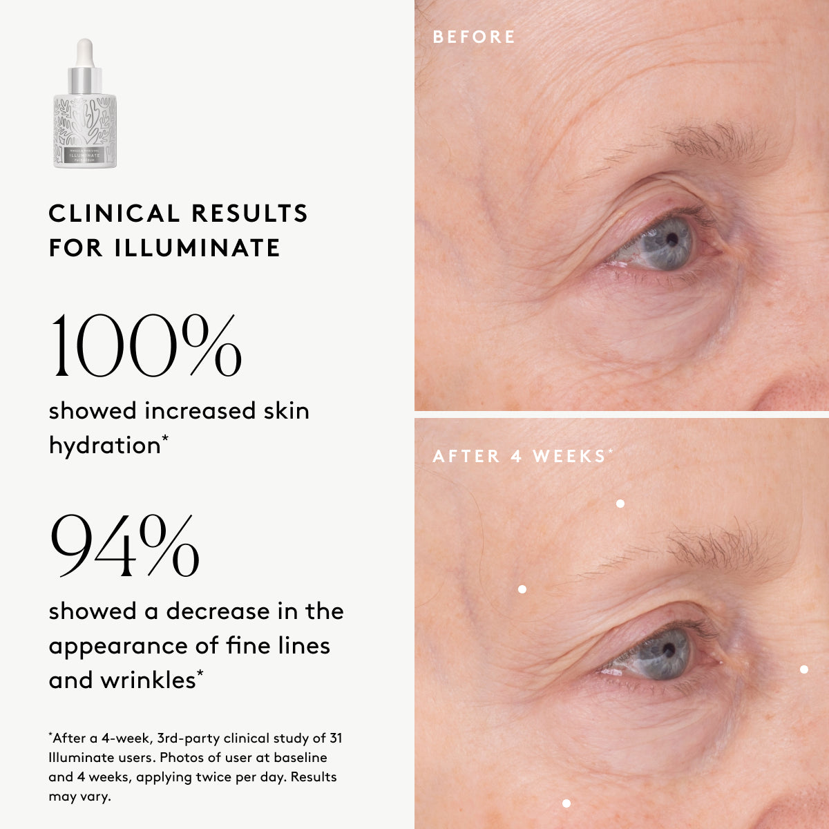 
                
                  Clinical results chart for Illuminate BC+ Brightening Serum: 100% showed increased visible hydration and 94% showed improved visible wrinkles
                
              