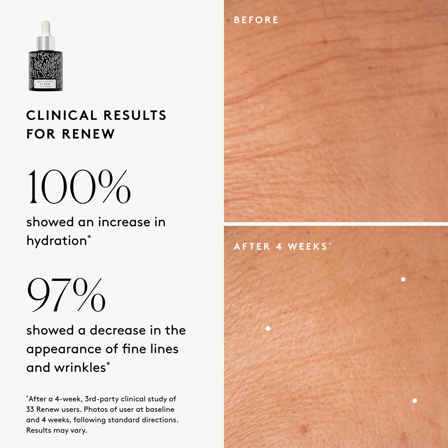 Clinical results chart for Renew Resurfacing Night Serum: 100% showed increased visible hydration and 97% showed improved visible wrinkles