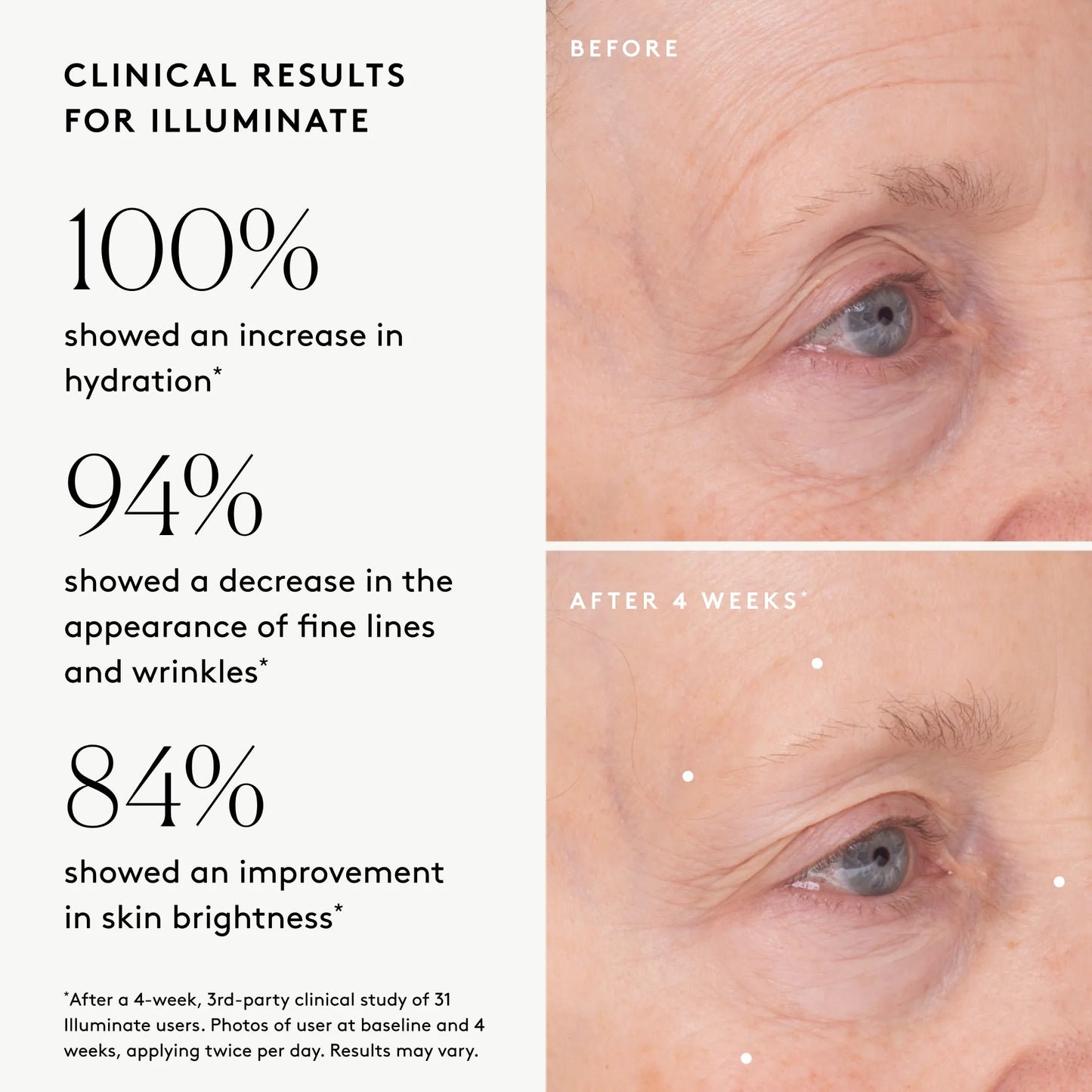 Clinical results chart for Illuminate BC+ Brightening Serum showing visibly improved hydration, fine lines and wrinkles, and brightness