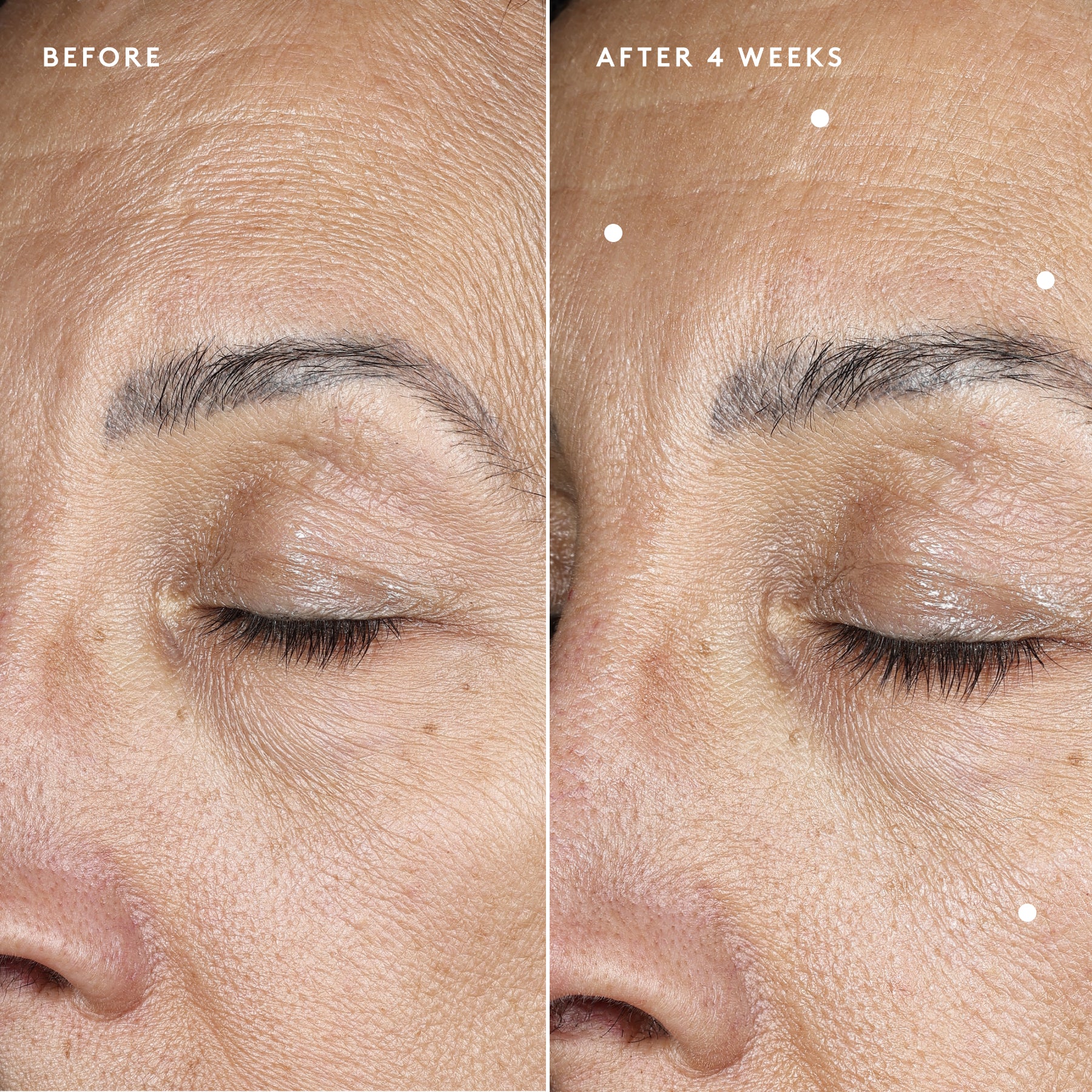 Before and After Image