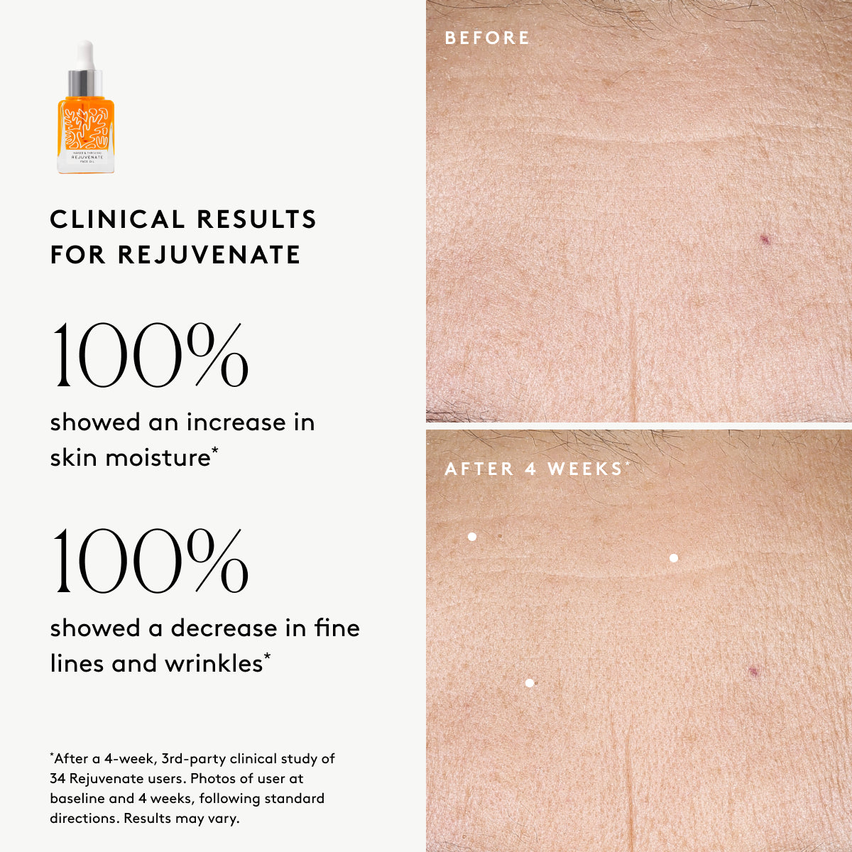
                
                  Clinical results chart for Rejuvenate Restorative Face Oil: 100% showed an increase in moisture and 100% showed improved visible lines and wrinkles  
                
              