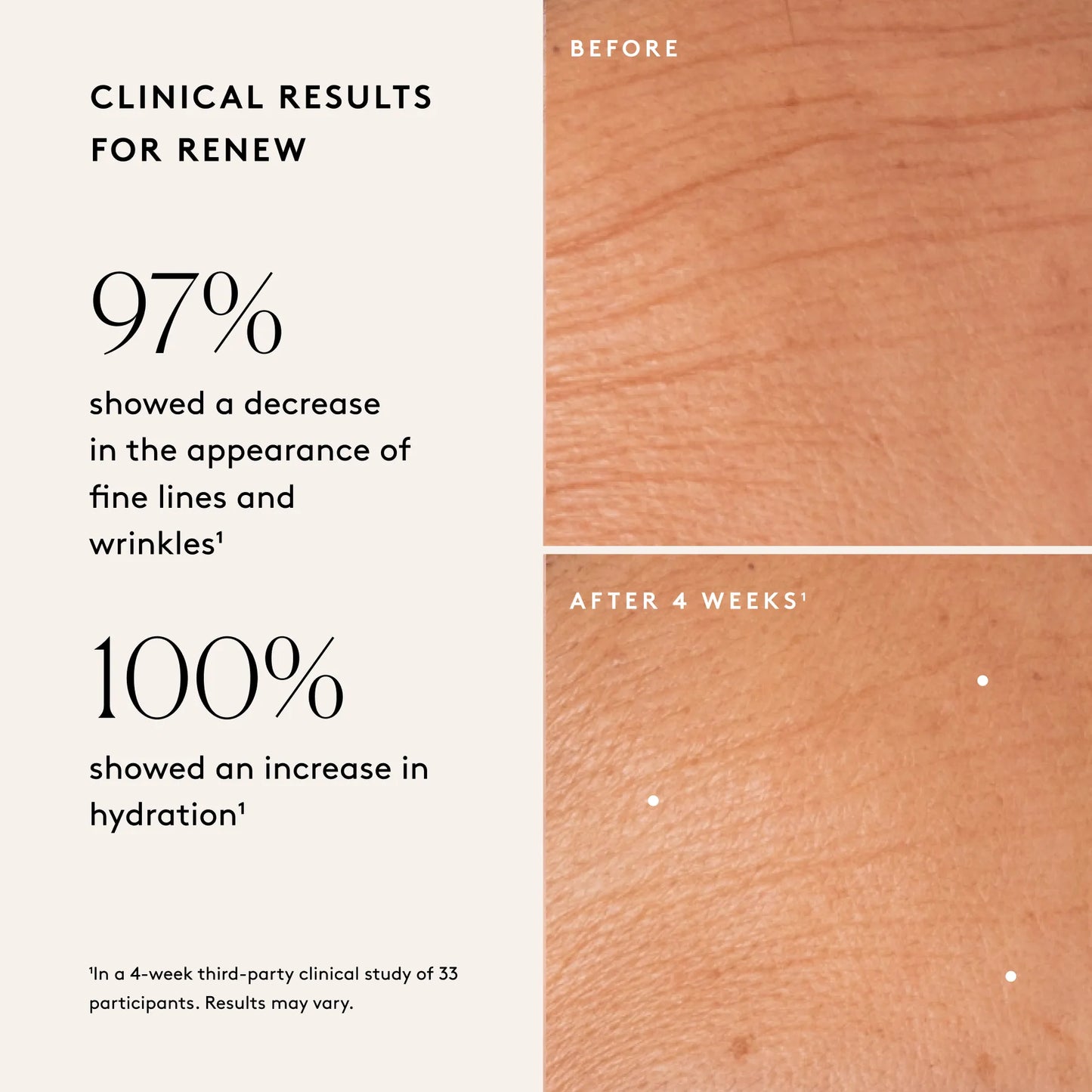 Renew Resurfacing Night Serum