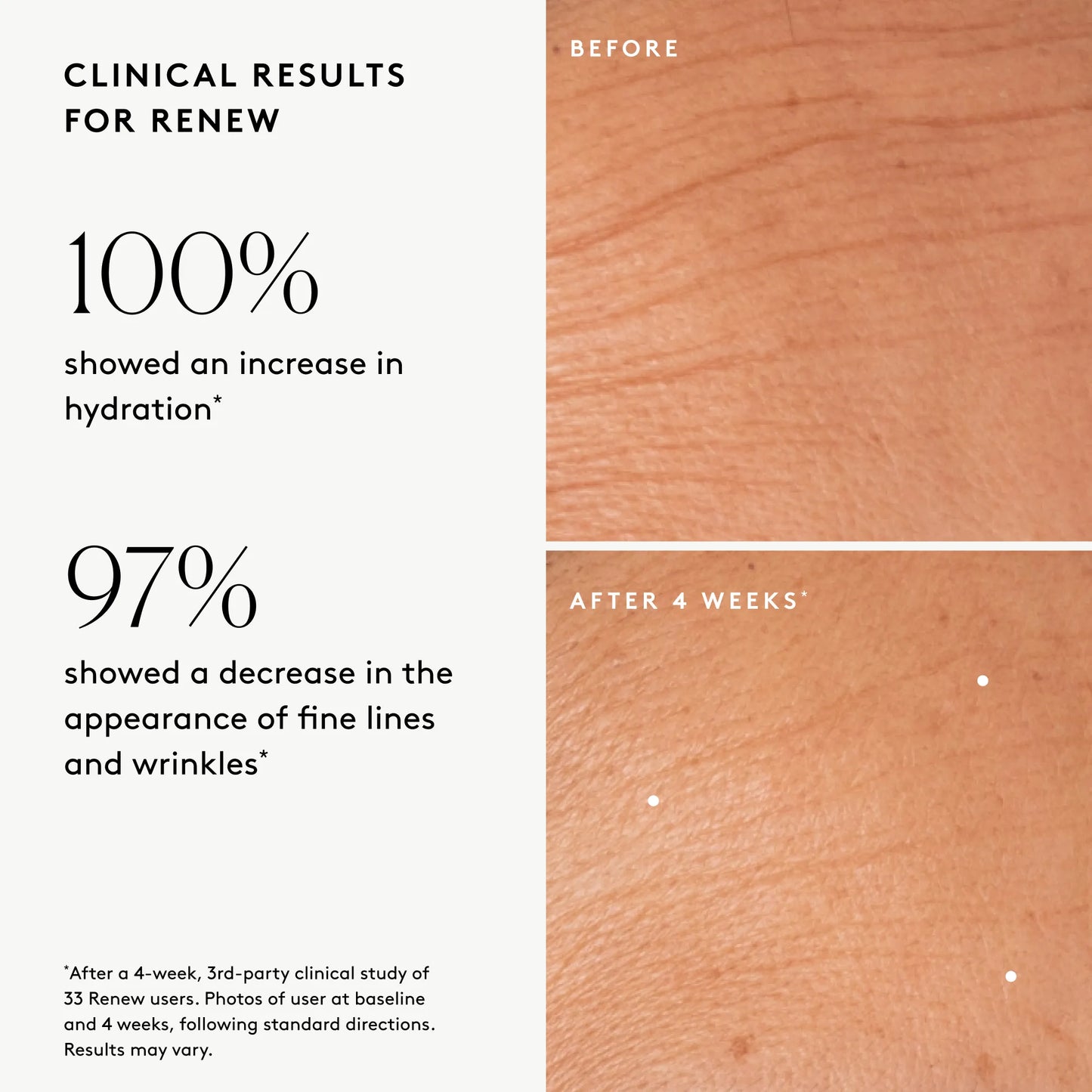 Clinical results chart for Renew Resurfacing Night Serum: 100% showed increased visible hydration and 97% showed improved visible wrinkles