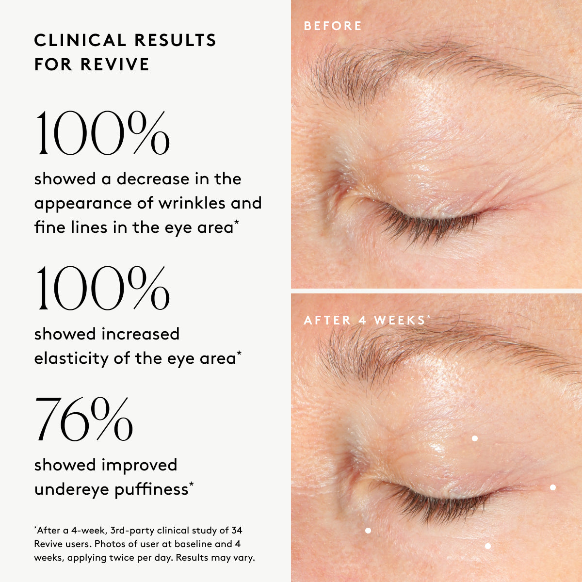 
                
                  Clinical results chart for Revive Firming Eye Cream showing visible improvements in fine lines, elasticity, and puffiness in the eye area
                
              
