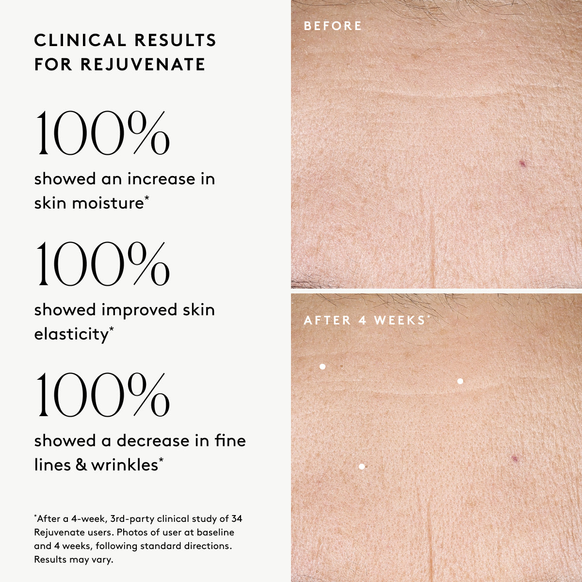 Wrinkle & Dark Spot Correcting Gift Set: For a firm, radiant complexion