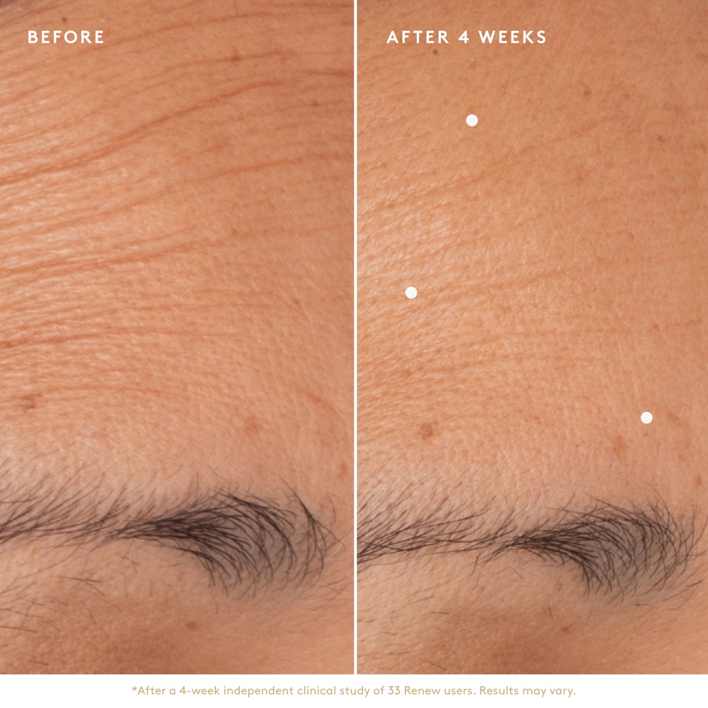 Renew Resurfacing Night Serum – Naked & Thriving Skincare